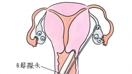 幼儿学画画，东莞捐卵宝宝学画画，学画画的好处，如何学画画