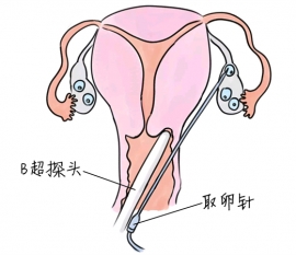 幼儿学画画，东莞捐卵宝宝学画画，学画画的好处，如何学画画