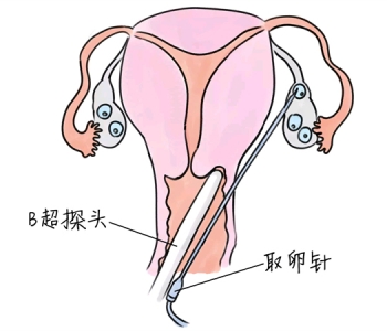 幼儿学画画，东莞捐卵宝宝学画画，学画画的好处，如何学画画
